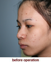 plastic_surgery_augmentation_rhinoplasty